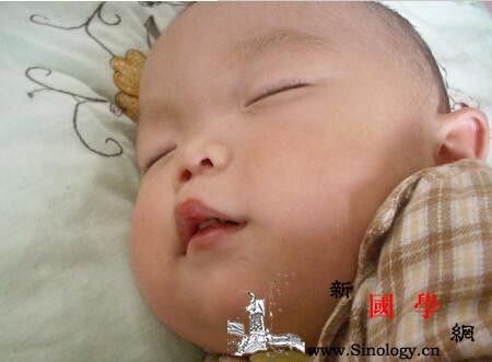 孩子嘴巴肿怎么回事_组胺-水肿-怎么回事-嘴巴-