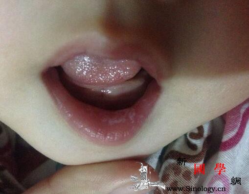 孩子嘴巴边小疙瘩怎么回事_怎么回事-解决方法-症状-嘴巴-