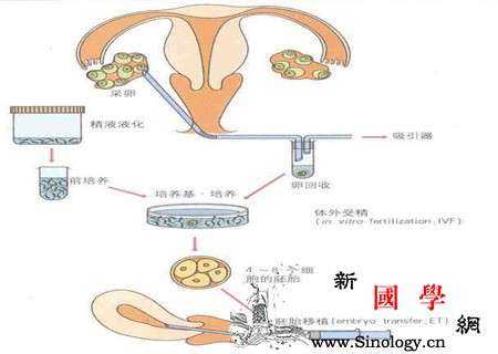 试管婴儿详细步骤各个流程分析_卵泡-试管婴儿-胚胎-移植-