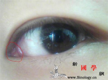 宝宝眼睛有红血丝怎么回事_结膜炎-进了-异物-怎么回事-