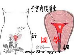子宫内膜过厚哪些食物应少吃？_钠盐-寒凉-生冷-酸涩-孕前饮食