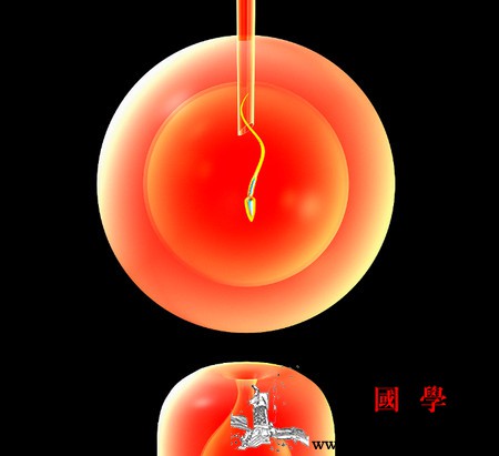 做试管婴儿夫妻俩都需要什么条件？_试管婴儿-输卵管-胚胎-移植-不孕不育 ()