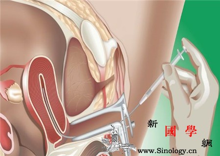 试管婴儿的利与弊这些方面是关键_囊胚-授精-试管婴儿-胚胎-