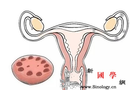 多囊卵巢怀孕几率多大看看多囊多了啥？_卵泡-排卵-受孕-卵巢-怀孕准备
