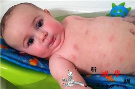 宝宝奶粉过敏的症状_皮疹-腹泻-奶粉-症状-