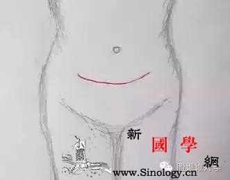 看图！产科医生画你知剖宫产后为啥需要避孕？_瘢痕-子宫-避孕-肌纤维-