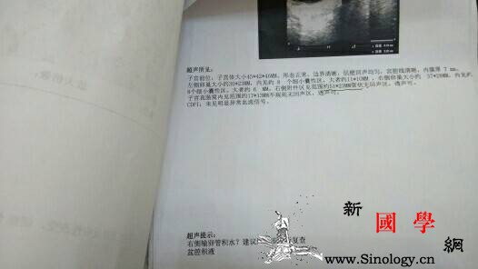 产后护理|女人不会照顾自己和孩子这就_灰指甲-脚气-湿疹-孩子-