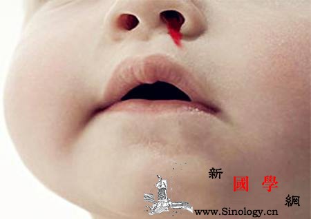 孩子鼻子出血是怎么回事_鼻腔-异物-粘膜-外伤-