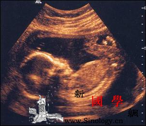 十大怀孕现象：男宝宝在子宫里勃起_男婴-勃起-孕妇-怀孕-