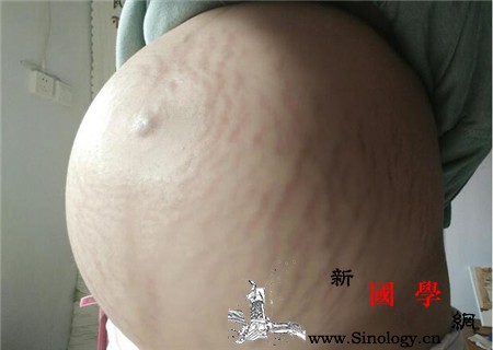 孕期如何防止妊娠纹_精油-橄榄油-松弛-腹部-