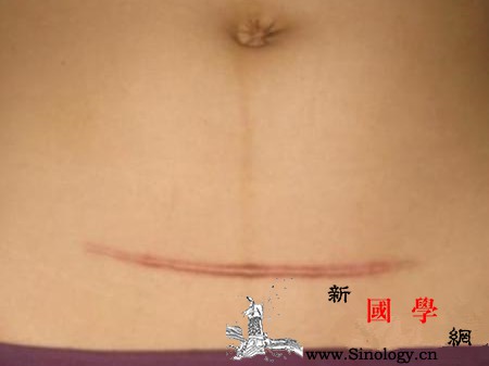 剖腹产后遗症有哪些_肺动脉-栓塞-剖腹产-产妇-