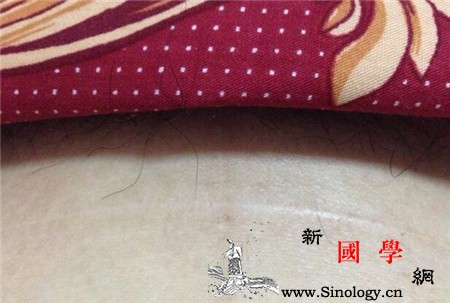 剖腹产线头_羊肠线-缝合线-线头-剖腹产-