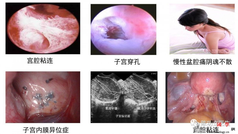 8大避孕方法_避孕药-极好-禁用-避孕-两性知识