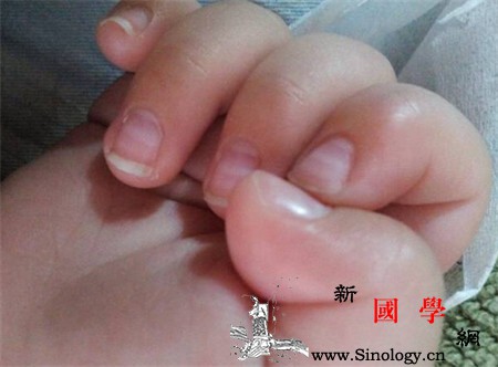 宝宝身体怎么样?看看指甲就明了_白点-指甲-导致-颜色-