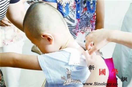 小孩贴三伏贴好吗孩子能贴三伏贴吗_伏贴-穴位-经络-哮喘-