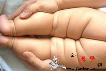 宝宝髋关节发育不良症状怎么判断孩子是否髋关_婴幼儿-关节-症状-判断-