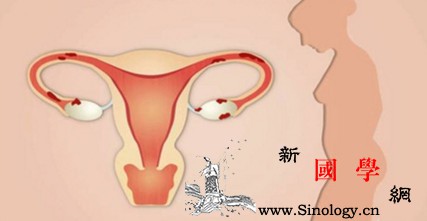 女性患有子宫内膜异位症还可以怀孕吗？_试管婴儿-卵巢-子宫-异位症-孕前检查