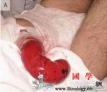 坐月子一定做到的7件事！不要毁掉女人一生幸福_会阴-消毒液-产后-子宫-