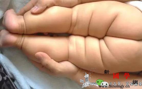 宝宝腿纹不对称？这可不能大意会导致双腿长短_双腿-关节-合上-宝宝-