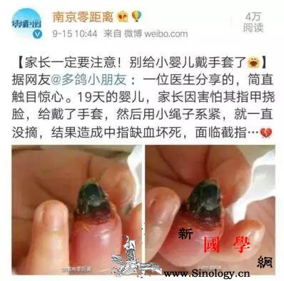 小宝宝到底能不能戴手套？_指甲-手套-手指-宝宝-