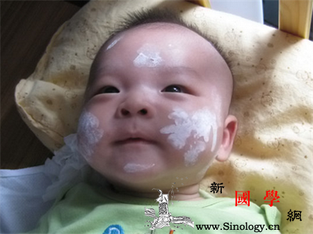 炉甘石洗剂婴儿能用吗_洗剂-毛发-皮肤病-副作用-