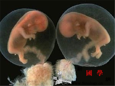 葡萄胎多久能发现_葡萄胎-超声-妊娠-阴道-