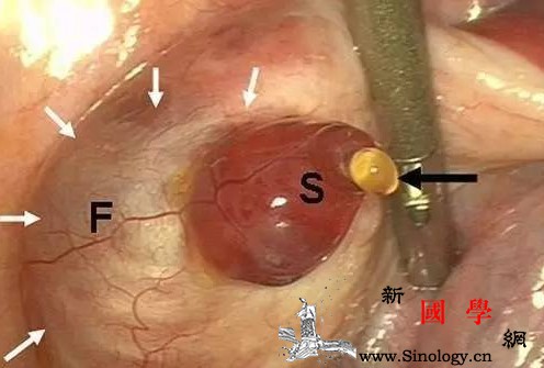 结婚多长时间没有怀孕就是有问题？女人是怎么怀_输卵管-卵子-精子-怀孕-孕前检查