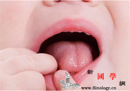 宝宝舌头发黄是怎么回事_寄生虫病-脾胃-舌头-见于-