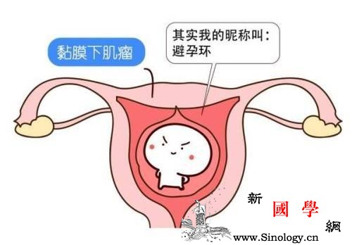 影响女性怀孕的因素有哪些？你中招了吗？_输卵管-受孕-宫颈-卵巢-怀孕准备