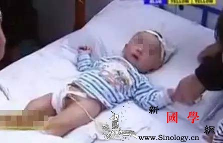 奶奶说小儿疝气会自愈拖到最后男宝宝两颗蛋蛋_疝气-腹股沟-孩子-阴囊-
