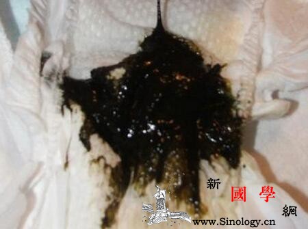 婴儿大便颜色常识图解_喂养-图解-配方-婴儿-