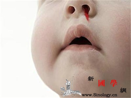 孩子晚上睡觉时流鼻血是怎么回事_外伤-出血-睡觉时-血管-