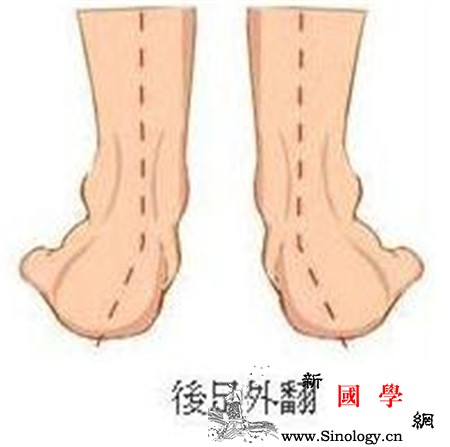 怎么判断足内翻外翻_脚掌-脚踝-脚跟-磨损-