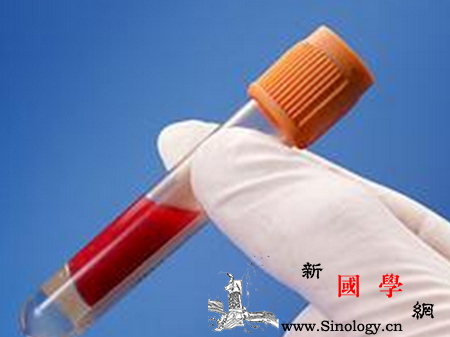 怀孕4周做什么检查_孕妇-准妈妈-含量-怀孕-