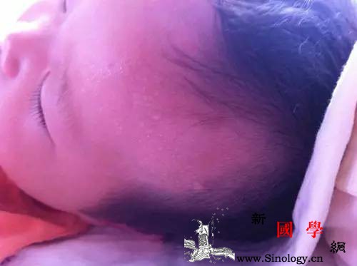 宝宝睡觉出汗多、枕秃是缺钙吗？_头发-后脑勺-出汗-枕头-