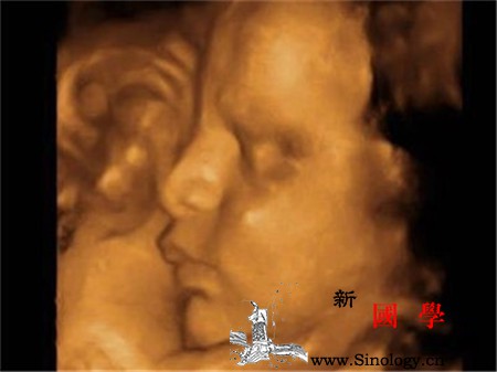 怀孕25周还能做四维吗_诊断仪-超声-胎儿-畸形-