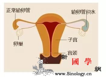 想要好孕不要积水输卵管积水是什么？_输卵管-胚胎-积水-炎症-孕前检查