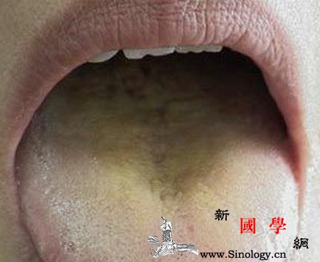 舌苔黄腻有齿痕是怎么回事？体内有湿毒？_热化-阳虚-舌苔-湿热-两性知识