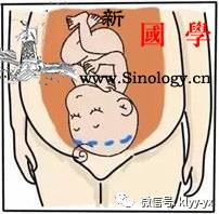 你的剖宫产疤痕有救啦总结的太走心_精油-结痂-疤痕-刺痒-
