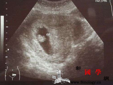 怀孕6周可以看见胎心胎芽吗_妊娠-胎儿-分化-器官-