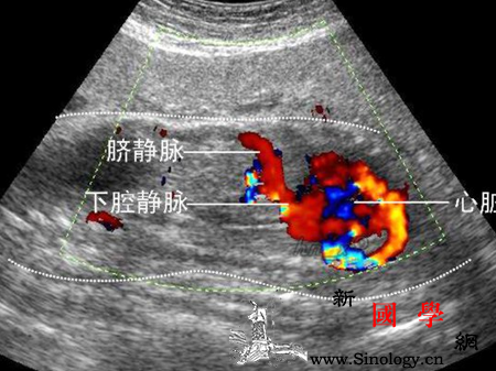怀孕5周可以做彩超吗_宫内-胎儿-四维-怀孕-