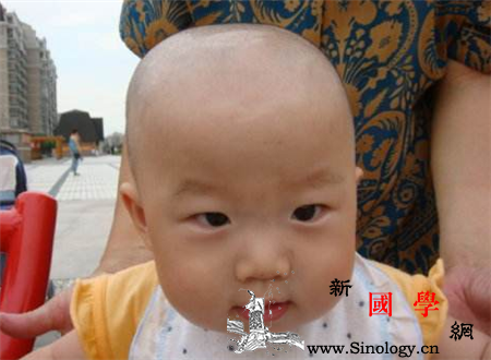 宝宝剃光头后注意事项_剃光头-暴晒-头发-湿疹- ()