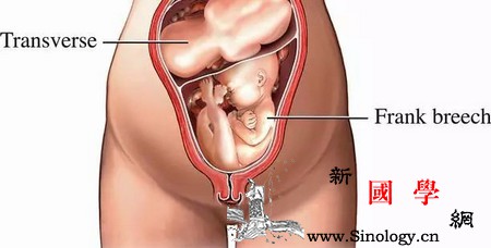 你知道双胞胎及多胞胎是如何形成的吗？_补血-摄入-双胞胎-需要注意-生男生女