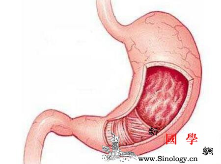 儿童幽门螺杆菌感染的症状_幽门-腹痛-螺杆-根治-
