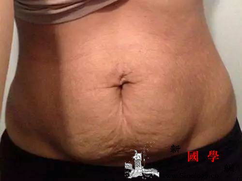 生完孩子后为啥身材迟迟不恢复？_腹壁-产后-腹部-分离-