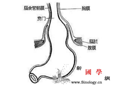 先天性膈疝的症状_裂孔-食管-脏器-腹腔-