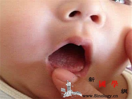 宝宝舌苔厚白怎么去掉护理的时候要注意这几点_舌苔-纱布-食物-宝宝-