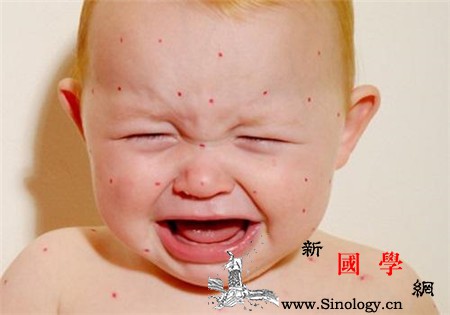 夏天宝宝头上长红疙瘩怎么回事夏天警惕湿疹和_痱子-头上-湿疹-怎么回事-