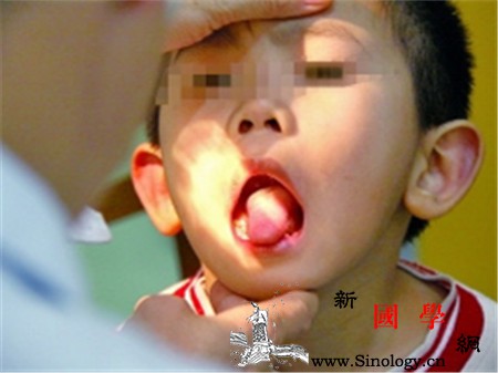 宝宝舌系带短什么时候剪分为两个时间窗口_舌系带-什么时候-手术-宝宝-