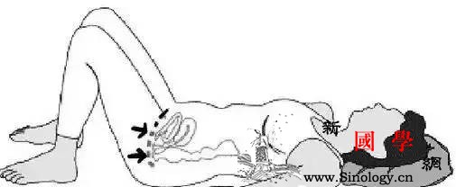 产后尿失禁？原来是盆底松弛惹的祸_顺产-骨盆-松弛-阴道-